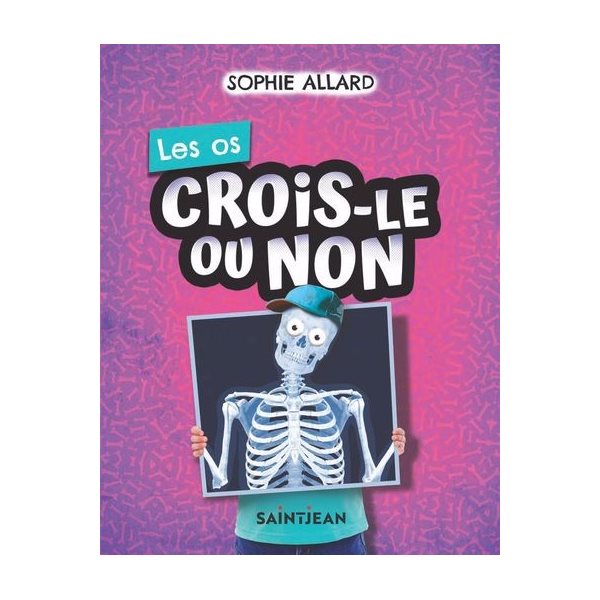 Les os, Crois-le ou non